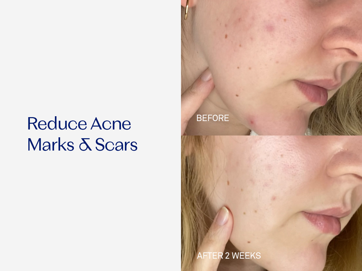 RescueMD DNA Repair Complex Scar Treatment Serum, Redness and Skin Damage Solution, 30mL