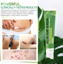 advanced-keloid-bump-removal-gel-silicon-5.jpg