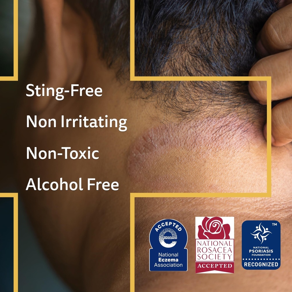 a-d-advanced-dermatitis-care-hydrogel-sp-6.jpg