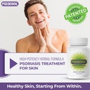 psoriasis-support-for-skin-120-herbal-ca-5.jpg
